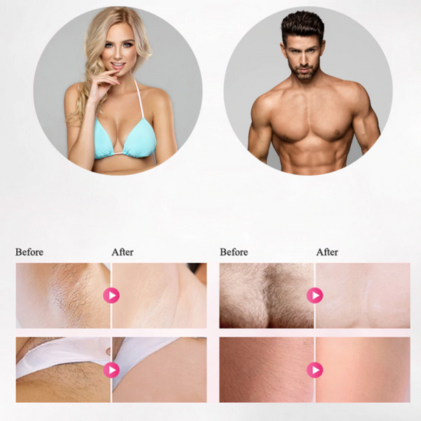 IPL LASER HAIR REMOVAL HANDSET